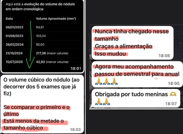 Exame de nódulo antes e depois