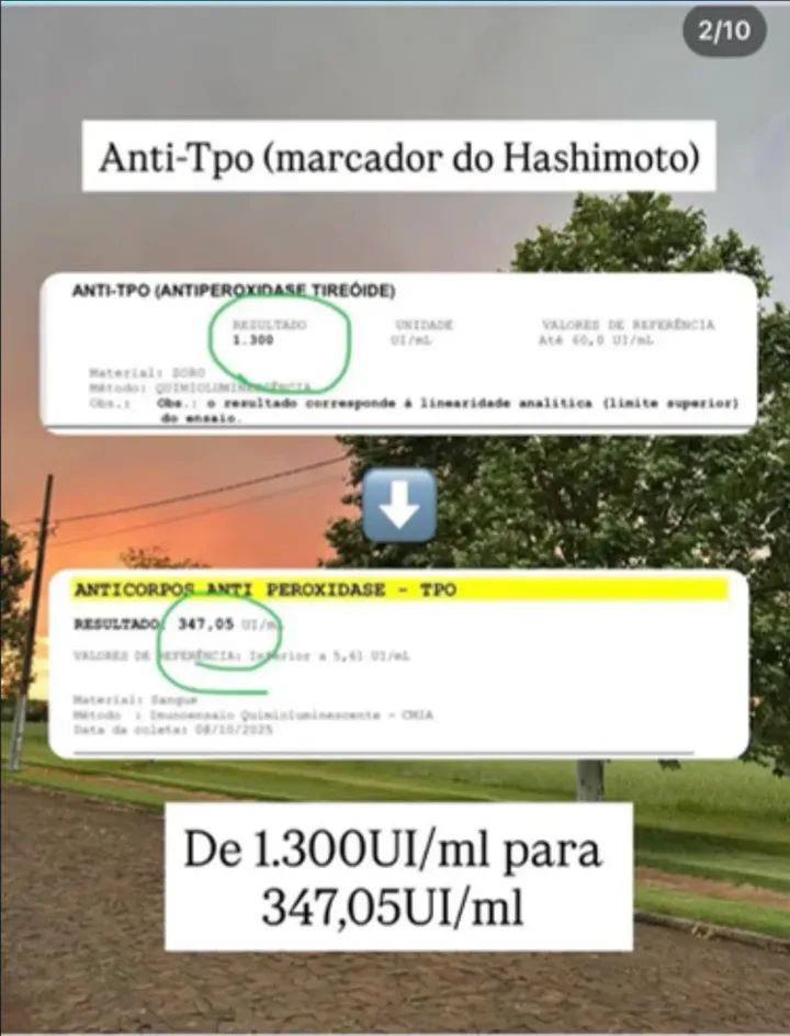 Exame do anti-TPO antes e depois